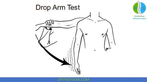 better to do drop arm test seated or standing|what is drop arm test.